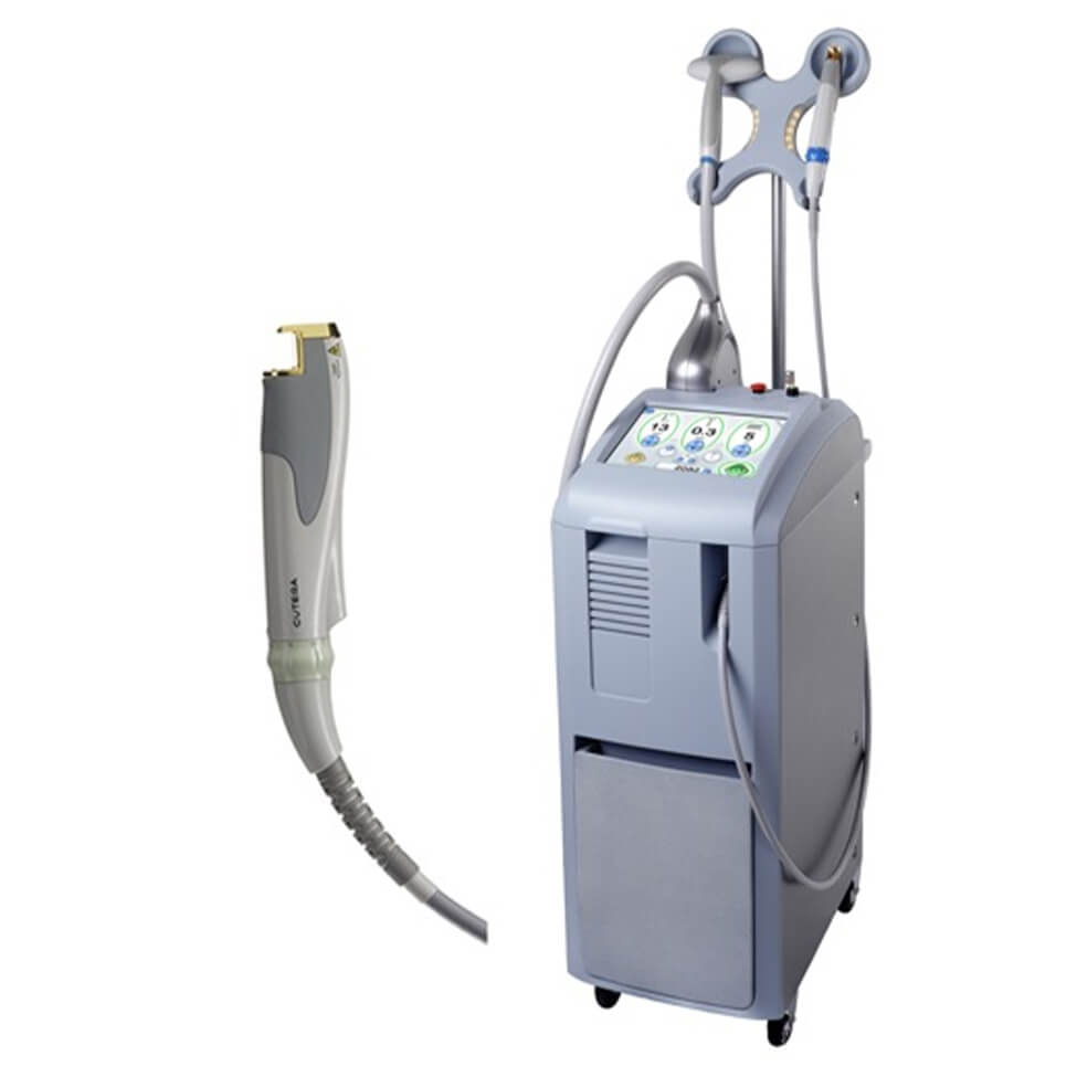 ジェネシス（YAGレーザー）